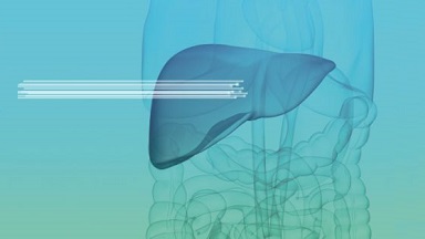 Kognitive Computerassistenten helfen Medizinern bei Diagnose- und Therapieentscheidungen.